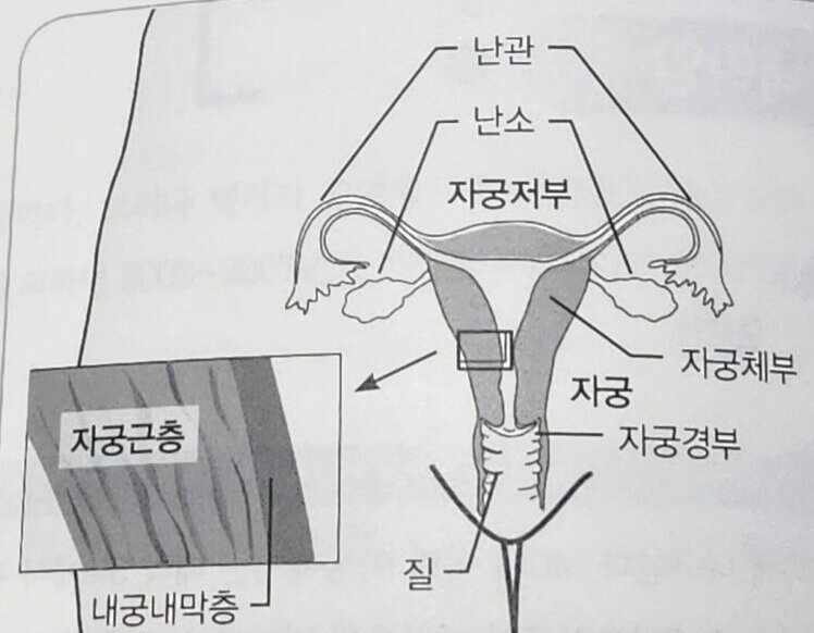 자궁내막암이란